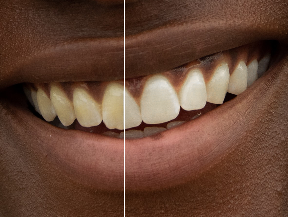 Come sbiancare i denti in Photoshop